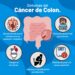 SE DIAGNOSTICAN CASI 2 NUEVOS CASOS DE CÁNCER DE COLON POR HORA EN ARGENTINA