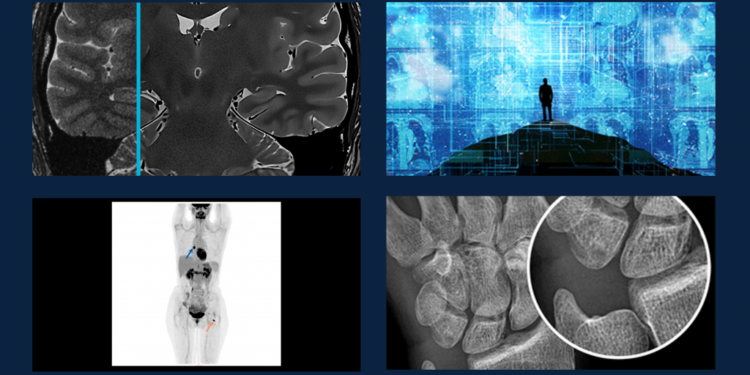 Evolución de la radiología: innovación y seguridad en el cuidado de la salud