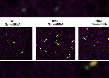 Científicas del CONICET avanzan en el desarrollo de una terapia innovadora para enfermedades neurodegenerativas
